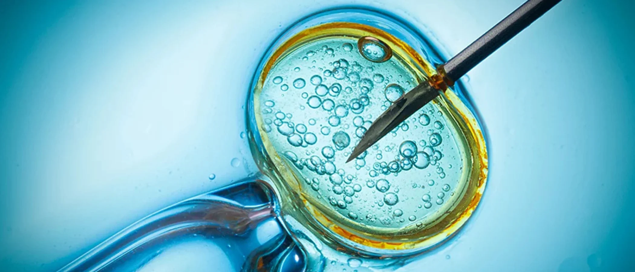 BB Life Surrogacy Services - PGT : Genetic Diagnosis