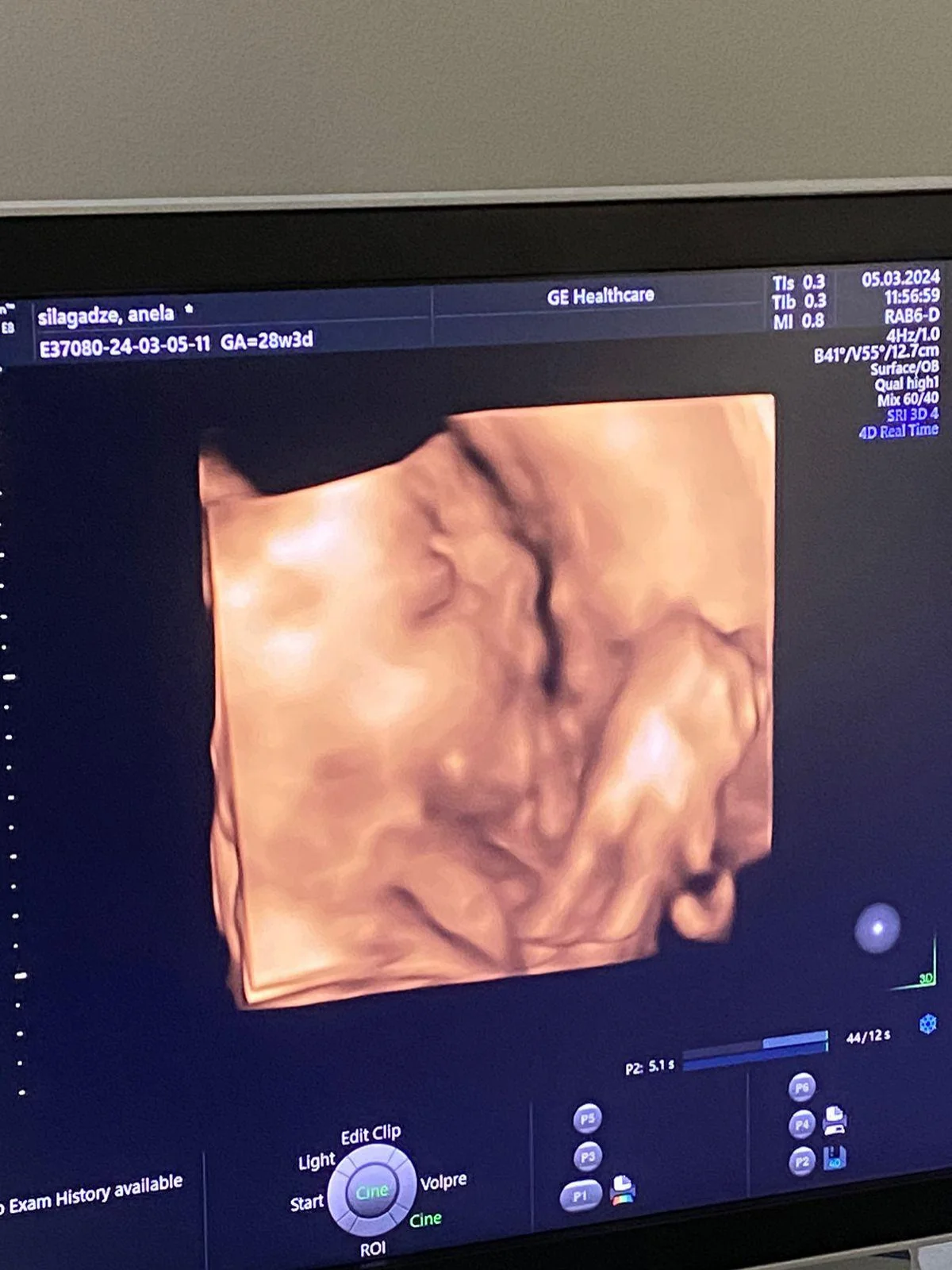 BB Life Surrogacy - Gallery