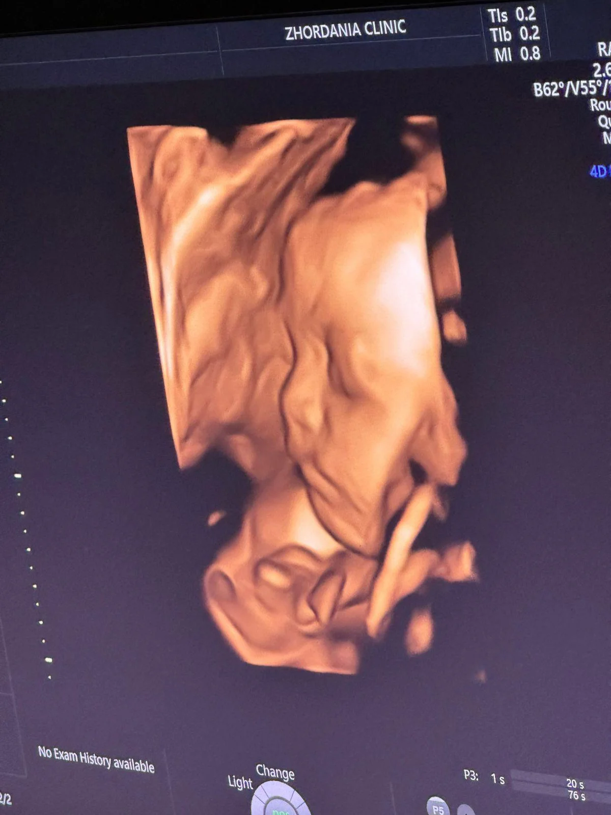 BB Life Surrogacy - Gallery