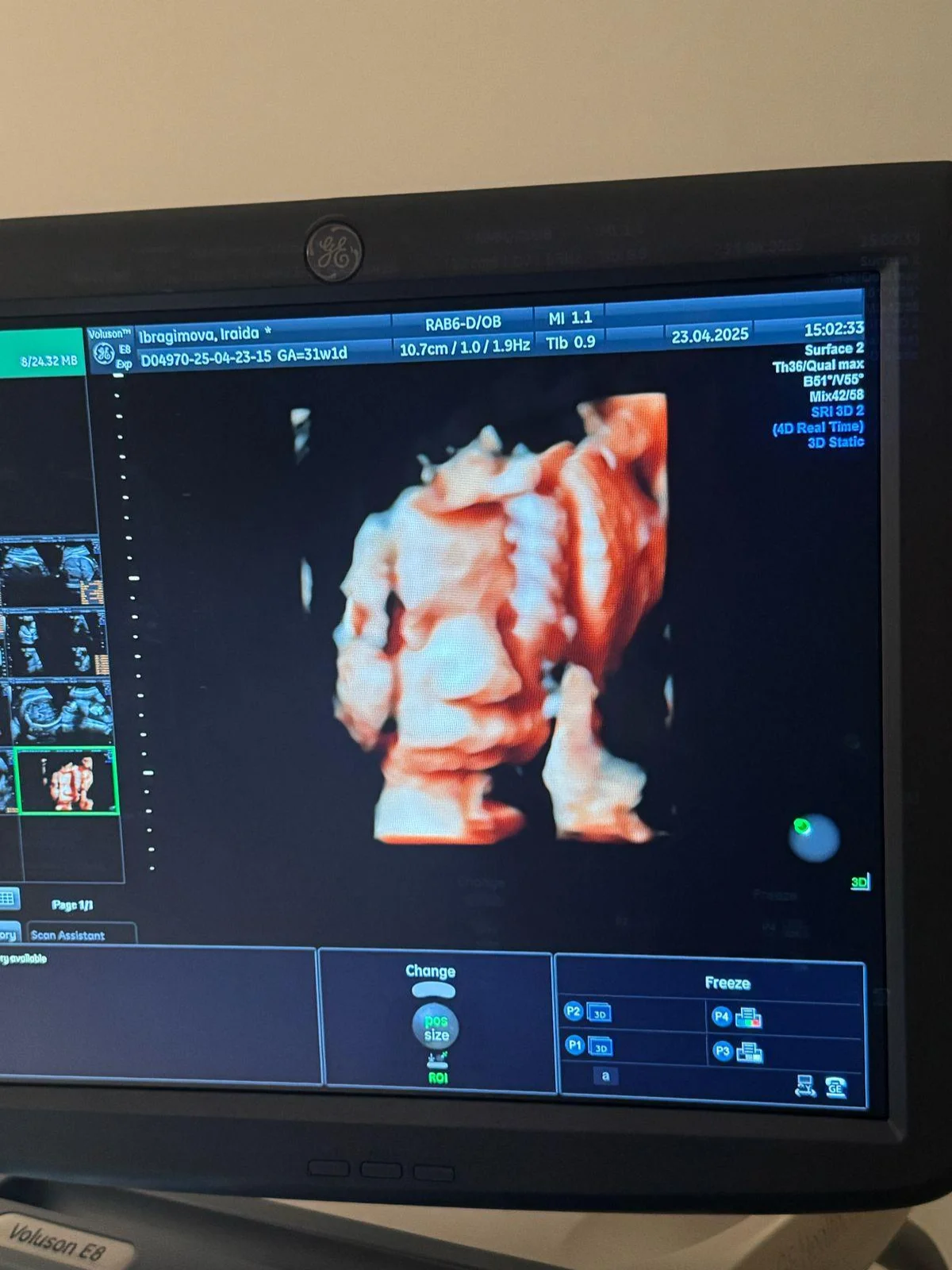 BB Life Surrogacy - Gallery